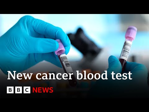 Blood test for more than 50 cancers 'shows promise' in study - BBC News