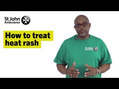How to Treat Heat Rash - First Aid Training - St John Ambulance