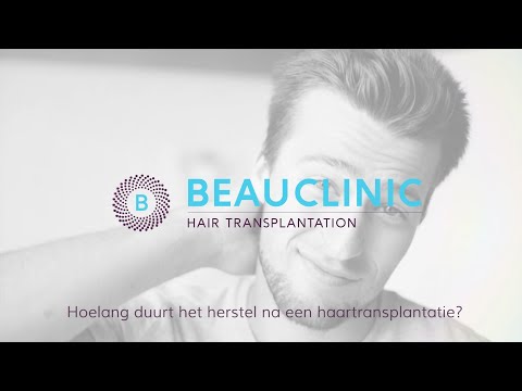 Hoelang duurt het herstel na een haartransplantatie?