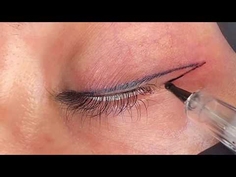 Permanent Eyeliner (Live Procedure) - Episode 14