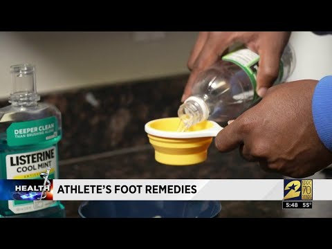 How to help knock out Athlete's Foot