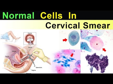 Normal Cells in Cervical Smear  ( Clear Explain )